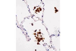 Paraformaldehyde-fixed, paraffin embedded Human lungtissue, Antigen retrieval by boiling in sodium citrate buffer (pH6. (FABP4 Antikörper)