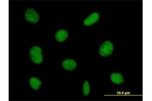 Immunofluorescence of purified MaxPab antibody to ZNF624 on HeLa cell. (ZNF624 Antikörper  (AA 1-739))
