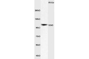 Rat Brain lysates probed with Rabbit Anti-ApoER2 Polyclonal Antibody (ABIN719426) at 1:200 in 4 °C. (LRP8 Antikörper  (AA 851-963))