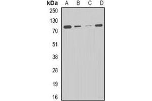 Western blot analysis of CPT2 expression in HepG2 (A), THP1 (B), mouse liver (C), mouse heart (D) whole cell lysates.