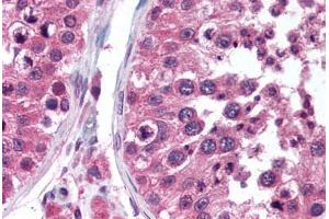 Human Testis (formalin-fixed, paraffin-embedded) stained with TEGT antibody ABIN290214 at 5 ug/ml followed by biotinylated anti-mouse IgG secondary antibody ABIN481714, alkaline phosphatase-streptavidin and chromogen. (Bax Inhibitor 1 Antikörper)