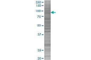 ARAF transfected lysate.