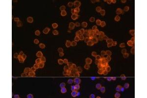 Immunofluorescence analysis of Raw264. (CD44 Antikörper)