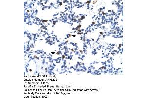 Human Lung (E2F6 Antikörper  (Middle Region))