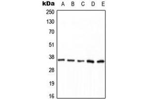 Western blot analysis of PPP2CA (pY307) expression in HEK293T EGF-treated (A), MCF7 (B), mouse brain (C), NIH3T3 (D), H9C2 EGF-treated (E) whole cell lysates. (PPP2CA Antikörper  (C-Term, pTyr307))