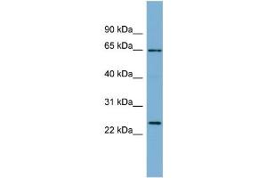 WB Suggested Anti-HOM-TES-103  Antibody Titration: 0. (IFFO1 Antikörper  (N-Term))