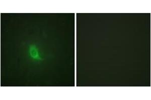 Immunofluorescence analysis of HuvEc cells, using SEPARASE (Phospho-Ser801) Antibody.