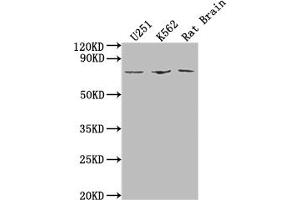 Western Blot Positive WB detected in: U251 whole cell lysate, K562 whole cell lysate, Rat Brain tissue All lanes: SGO1 antibody at 1:2000 Secondary Goat polyclonal to rabbit IgG at 1/50000 dilution Predicted band size: 65, 36, 34, 32, 30, 61, 25 kDa Observed band size: 65 kDa (Shugoshin Antikörper  (AA 260-439))