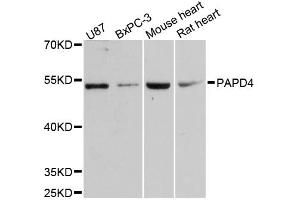 Western blot analysis of extracts of various cell lines, using PAPD4 antibody. (PAPD4 Antikörper)