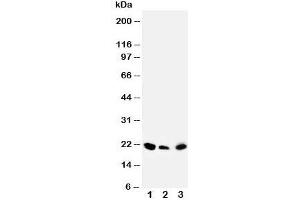Western blot testing of DUSP3 antibody and Lane 1:  rat testis;  2: human SKOV;  3: (h) MM453 cell lysate (Dual Specificity Phosphatase 3 (DUSP3) (C-Term) Antikörper)