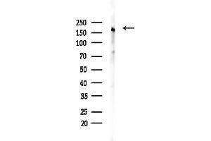 anti-Myomesin 2 (MYOM2) (Internal Region) antibody