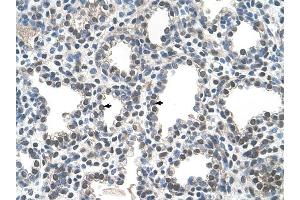 PPIB antibody was used for immunohistochemistry at a concentration of 4-8 ug/ml to stain Alveolar cells (arrows) in Human Lung. (PPIB Antikörper)