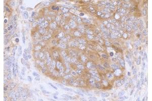 Immunohistochemistry (IHC) image for anti-Eukaryotic Translation Initiation Factor 3 Subunit A (EIF3A) (AA 860-910) antibody (ABIN7453842) (EIF3A Antikörper  (AA 860-910))