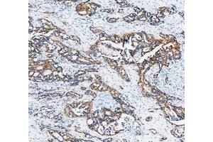 IHC analysis of Cytokeratin 20/Krt20 using anti-Cytokeratin 20/Krt20 antibody (ABIN7601133). (KRT20 Antikörper  (AA 29-431))
