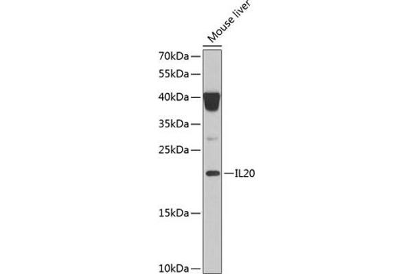 IL-20 antibody  (AA 25-176)