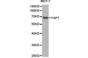 Western Blotting (WB) image for anti-Yes-Associated Protein 1 (YAP1) antibody (ABIN1875372) (YAP1 Antikörper)