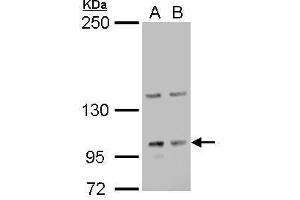 WB Image Laminin gamma 2 antibody detects Laminin gamma 2 protein by Western blot analysis. (LAMC2 Antikörper)