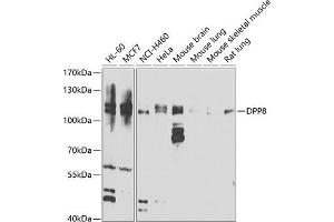 Western blot analysis of extracts of various cell lines, using DPP8 antibody (ABIN6130315, ABIN6139800, ABIN6139801 and ABIN6222925) at 1:1000 dilution. (DPP8 Antikörper  (AA 10-230))