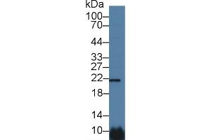 Detection of CSN1 in Human Hela cell lysate using Polyclonal Antibody to Casein Alpha (CSN1) (Casein alpha S1 Antikörper  (AA 16-185))
