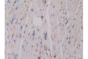 Detection of ITGb3 in Mouse Heart Tissue using Polyclonal Antibody to Integrin Beta 3 (ITGb3)