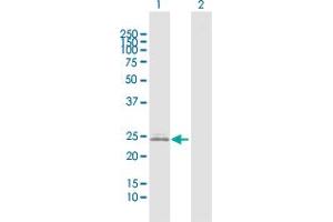 Western Blot analysis of IGKC expression in transfected 293T cell line by IGKC MaxPab polyclonal antibody. (IGKC Antikörper  (AA 1-234))