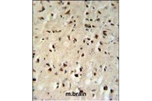 Immunohistochemistry (Paraffin-embedded Sections) (IHC (p)) image for anti-FK506 Binding Protein 1B, 12.6 KDa (FKBP1B) (AA 16-46), (N-Term) antibody (ABIN392348)