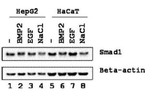 Image no. 1 for anti-SMAD, Mothers Against DPP Homolog 1 (SMAD1) (Ser206) antibody (ABIN401471) (SMAD1 Antikörper  (Ser206))