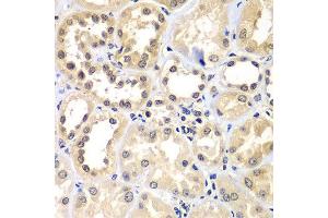 Immunohistochemistry of paraffin-embedded human kidney using ZNF264 antibody at dilution of 1:100 (x400 lens).