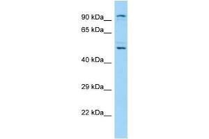 Western Blotting (WB) image for anti-Lysine (K)-Specific Demethylase 1B (KDM1B) (N-Term) antibody (ABIN2790414)