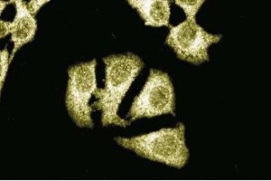 Immunofluorescent staining of HeLa cells with anti-Itch antibody. (ITCH Antikörper  (AA 114-220))