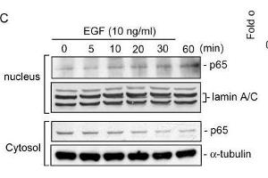 Western Blotting (WB) image for anti-Lamin A/C (LMNA) antibody (ABIN2854943)