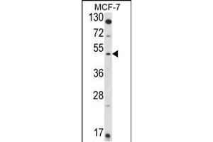 Western blot analysis of HSD11B2 Antibody (Center) (ABIN653721 and ABIN2843030) in MCF-7 cell line lysates (35 μg/lane). (HSD11B2 Antikörper  (AA 277-306))