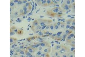 Figure. (ITGA5 Antikörper  (AA 895-1049))