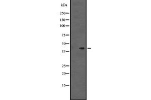 Western blot analysis of GPR86/GPR94 expression in Hela cell lysate,The lane on the left is treated with the antigen-specific peptide. (Purinergic Receptor P2Y, G-Protein Coupled, 13 (P2RY13) (C-Term) Antikörper)