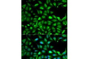 Immunofluorescence analysis of A-549 cells using IGF2 Polyclonal Antibody (IGF2 Antikörper)