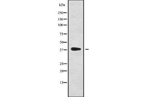 Western blot analysis NKX61 using HepG2 whole cell lysates (NKX6-1 Antikörper  (Internal Region))