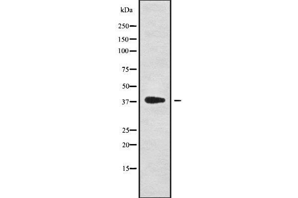 NKX6-1 Antikörper  (Internal Region)
