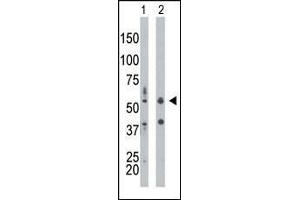 The anti-PRKR Pab (ABIN392778 and ABIN2837994) is used in Western blot to detect PRKR in mouse liver tissue lysate (Lane 1) and HepG2 cell lysate (Lane 2).