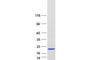 Western Blotting (WB) image for Ubiquitin-Conjugating Enzyme E2I (UBE2I) (Transcript Variant 4) protein (Myc-DYKDDDDK Tag) (ABIN2734774)