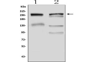 Western blot analysis of Gastric Mucin using anti-Gastric Mucin antibody (ABIN5693243).