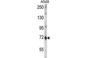 Western Blotting (WB) image for anti-Zinc Finger Protein 429 (ZNF429) antibody (ABIN2997034) (ZNF429 Antikörper)
