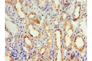 Immunohistochemistry (IHC) image for anti-Dishevelled, Dsh Homolog 2 (Drosophila) (DVL2) (AA 1-240) antibody (ABIN7168752)
