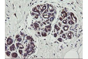 Immunohistochemical staining of paraffin-embedded Human breast tissue using anti-TPD52L3 mouse monoclonal antibody. (TPD52L3 Antikörper)