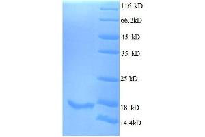 SDS-PAGE (SDS) image for Interleukin 15 (IL15) (AA 49-162), (full length) protein (His tag) (ABIN1047241)