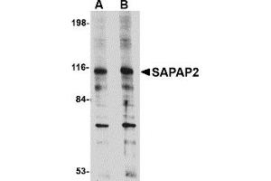 Western Blotting (WB) image for anti-Discs, Large (Drosophila) Homolog-Associated Protein 2 (DLGAP2) (Middle Region) antibody (ABIN1031077)