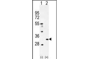 Western blot analysis of PRDX4 (arrow) using rabbit polyclonal PRDX4 Antibody (Center) (ABIN656035 and ABIN2845408).