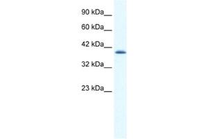 Western Blotting (WB) image for anti-Cation Channel, Sperm Associated 2 (CATSPER2) antibody (ABIN2461150) (CATSPER2 Antikörper)