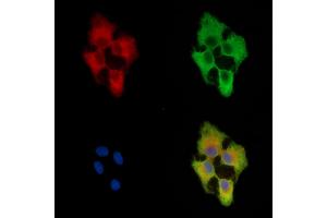 ABIN7096034 and ABIN7100096 staining  cells by IF/ICC.