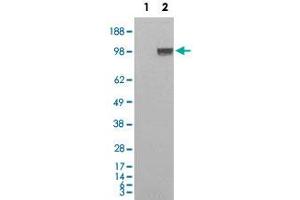 HEK293 overexpressing Human ENPP1 and probed with ENPP1 polyclonal antibody  (mock transfection in first lane) .