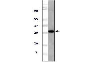 Western Blotting (WB) image for anti-Alveolar Soft Part Sarcoma Chromosome Region, Candidate 1 (ASPSCR1) (truncated) antibody (ABIN2464084) (ASPSCR1 Antikörper  (truncated))